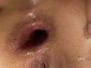 Linda Brown opens both holes