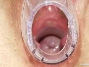 Kinky gyno doctor fingers pussy of hot brunet 10/16