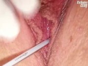 Britney teen gyno fetish pussy speculum exami 9/16