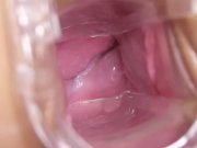 Barbara Bieber and Nathaly - Gyno plays 13/16