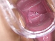 Barbara Bieber and Nathaly - Gyno plays 14/16